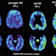 Image for article titled Can Science See Inside An NFL Player's Skull Before It's Too Late?